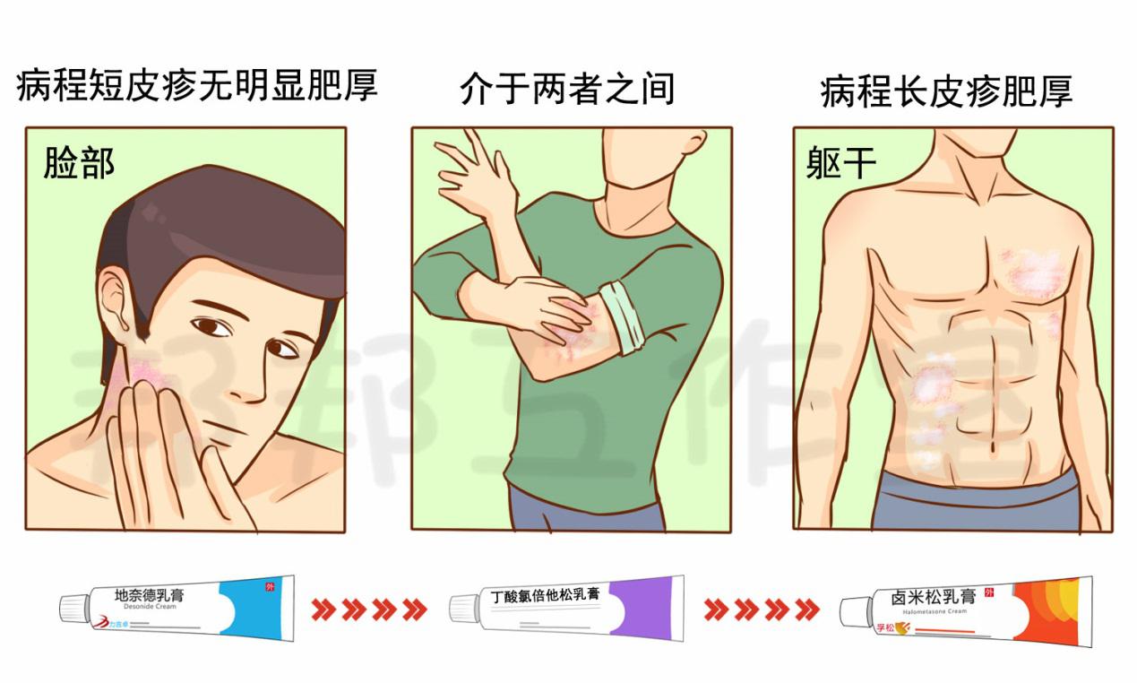 越挠越痒、精神压力大，要小心这个皮肤问题