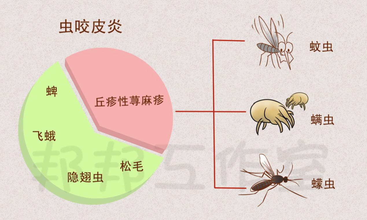 丘疹性荨麻疹患者的内心疑问：谁在咬我？该怎么办？