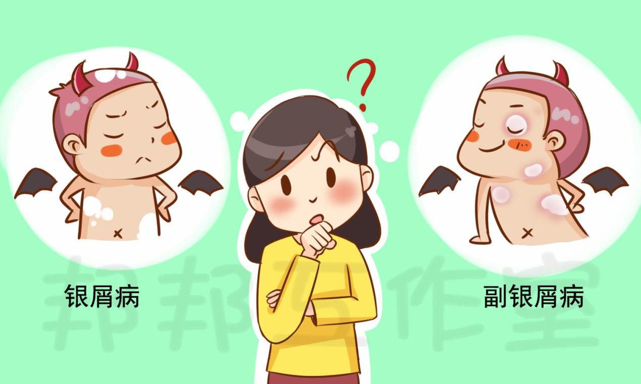 银屑病与副银屑病一字之差，哪个对人体危害大？