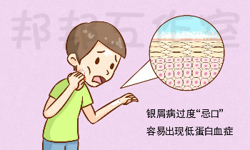 如何减缓银屑病复发？