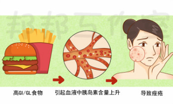 爱吃辣的人都爱长痘么？痘痘和饮食有什么关系