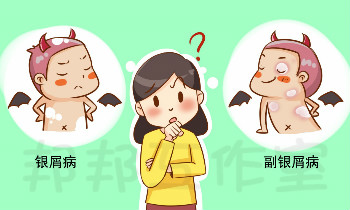 银屑病与副银屑病一字之差，哪种对人体危害大？