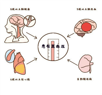 氨氯地平贝那普利片Ⅱ（地奥氨贝）疗效好，氨氯地平贝那普利片Ⅱ价格优势大