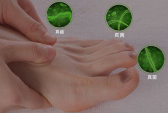 灰指甲脚趾甲盖疼怎么回事？怎么治疗效果好？