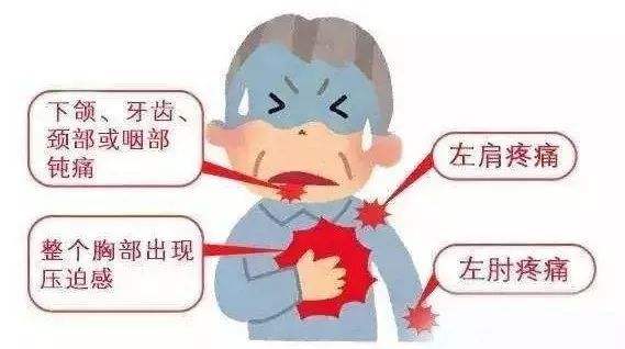 血管狭窄＞50%带来的危害不容小觑