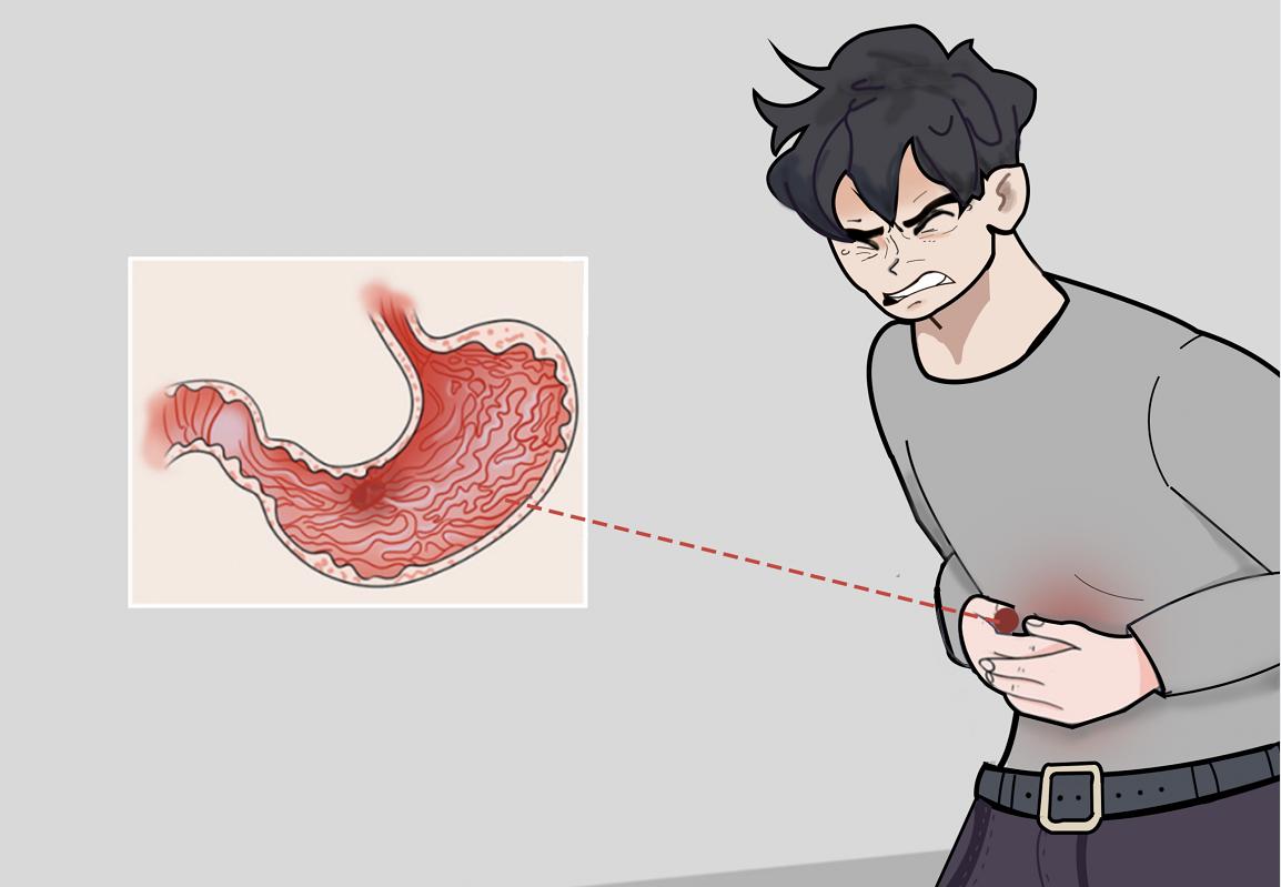 胃溃疡的症状有哪些，一不小心便成癌，要注意了！