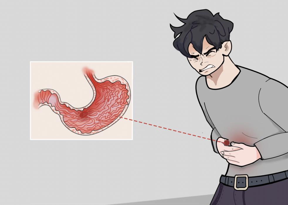 胃溃疡是怎么引起的？浓茶就不要再喝了