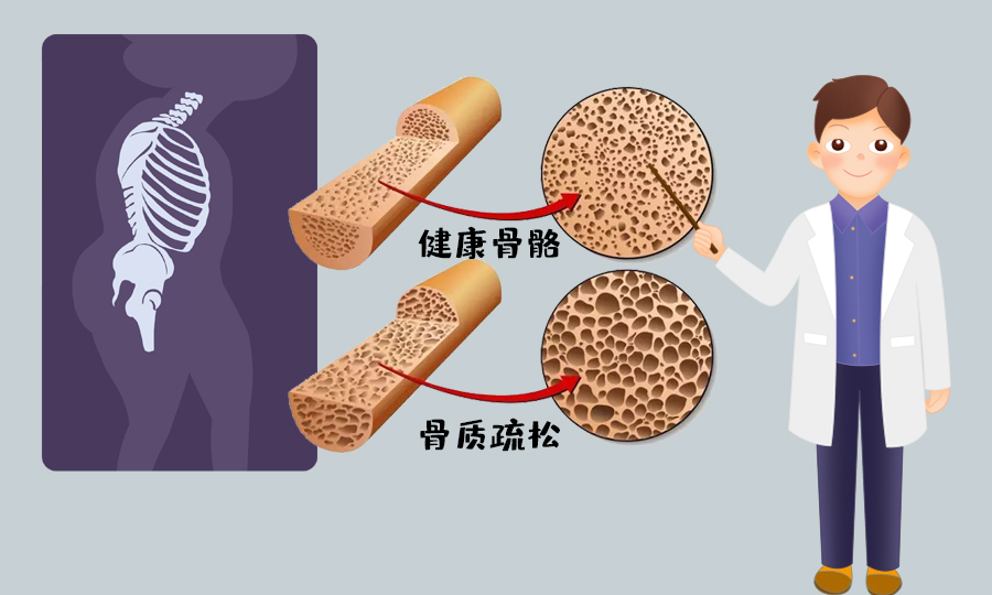 补肾抗衰系列谈——腰腿衰老并不是老年人的专利