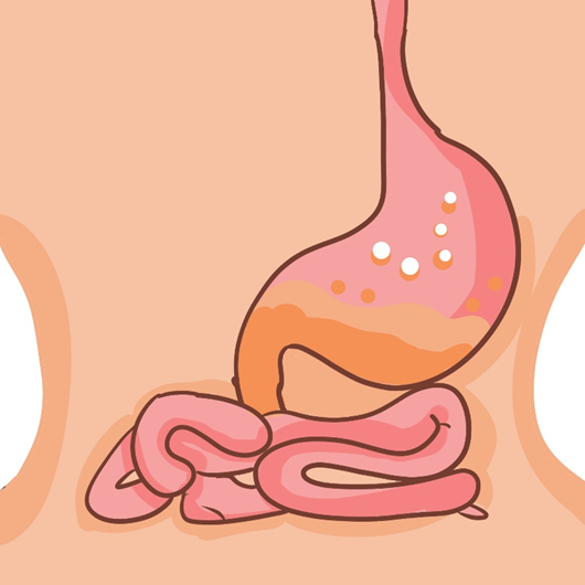 肠道敏感怎么回事？