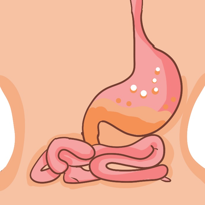 反流性胃炎怎么治疗效果好？