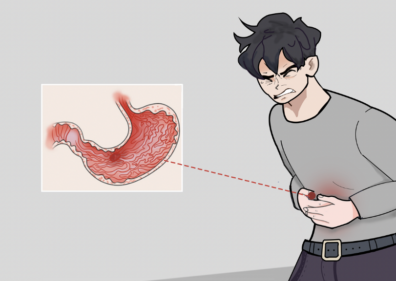 胃溃疡是怎么引起的？要怎么治疗？