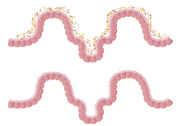 增加肠道好菌，提高免疫力！如何培养肠道有益菌？