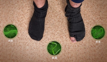 足部灰指甲早期症状有什么？及早发现才能及早治疗