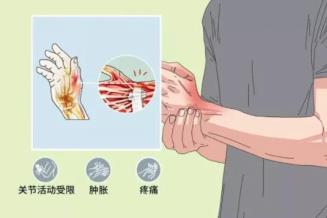 “鼠标手”你中招了吗