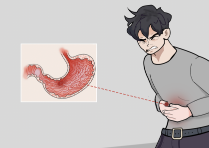 胃溃疡导致的胃疼吃奥美拉唑有用吗?